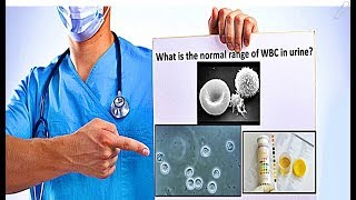 WBC in Urine  High Count Causes [upl. by Fernandina753]