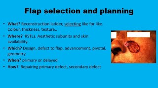 11 Facial flaps The Basics [upl. by Eladroc]